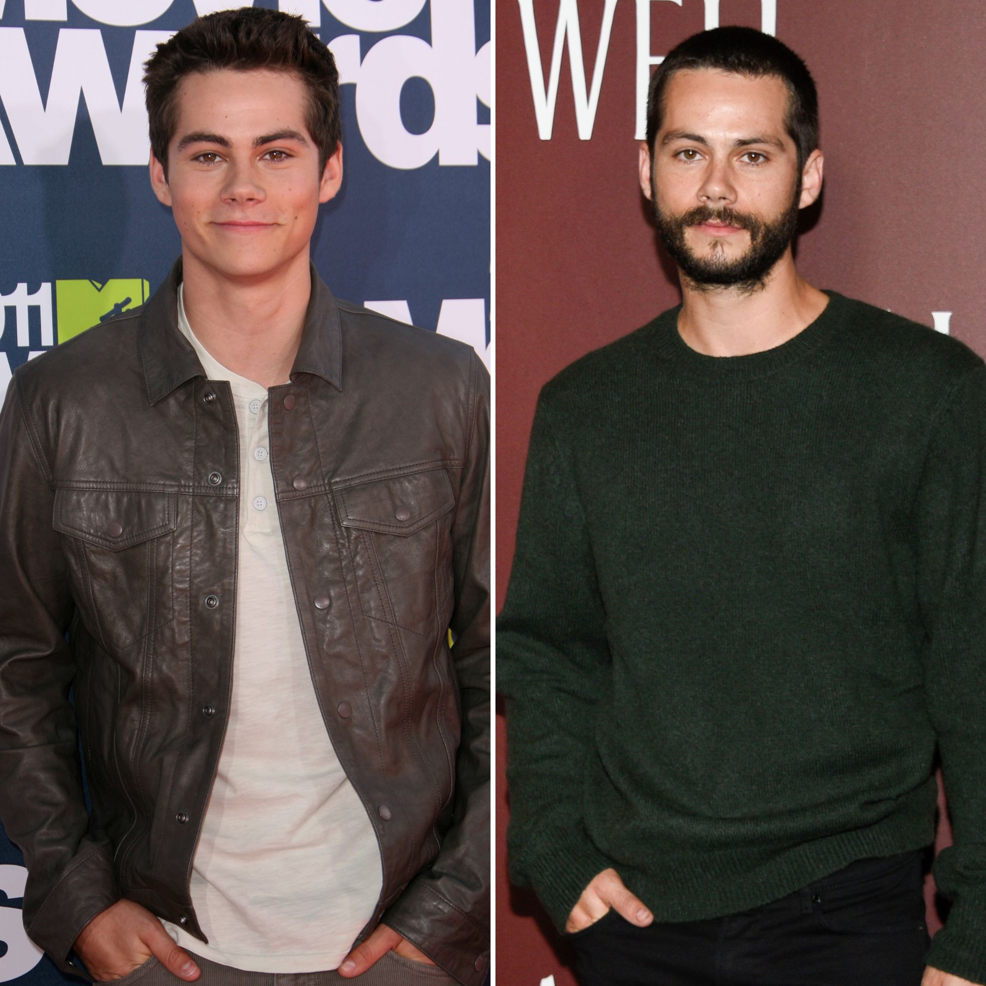 Dylan O'Brien Transformation Pictures: Then vs Now Photos